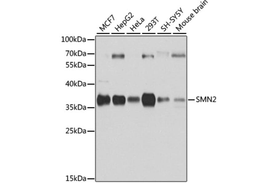 Western Blot - Anti-SMN/Gemin 1 Antibody (A89360) - Antibodies.com