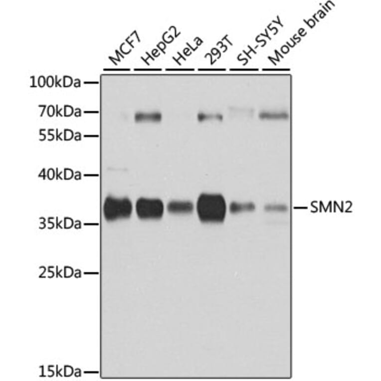 Western Blot - Anti-SMN/Gemin 1 Antibody (A89360) - Antibodies.com