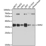 Western Blot - Anti-SMN/Gemin 1 Antibody (A89360) - Antibodies.com