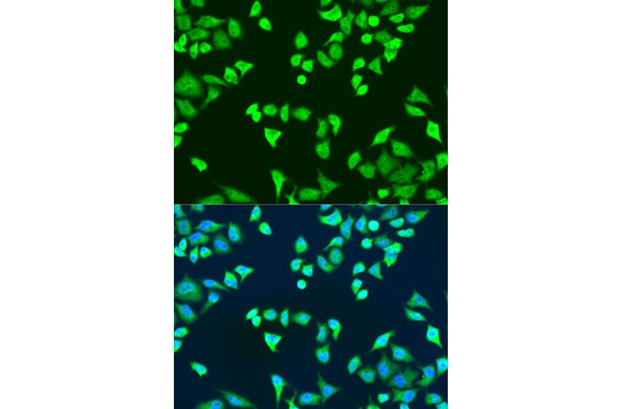 Immunofluorescence - Anti-SMN/Gemin 1 Antibody (A89360) - Antibodies.com