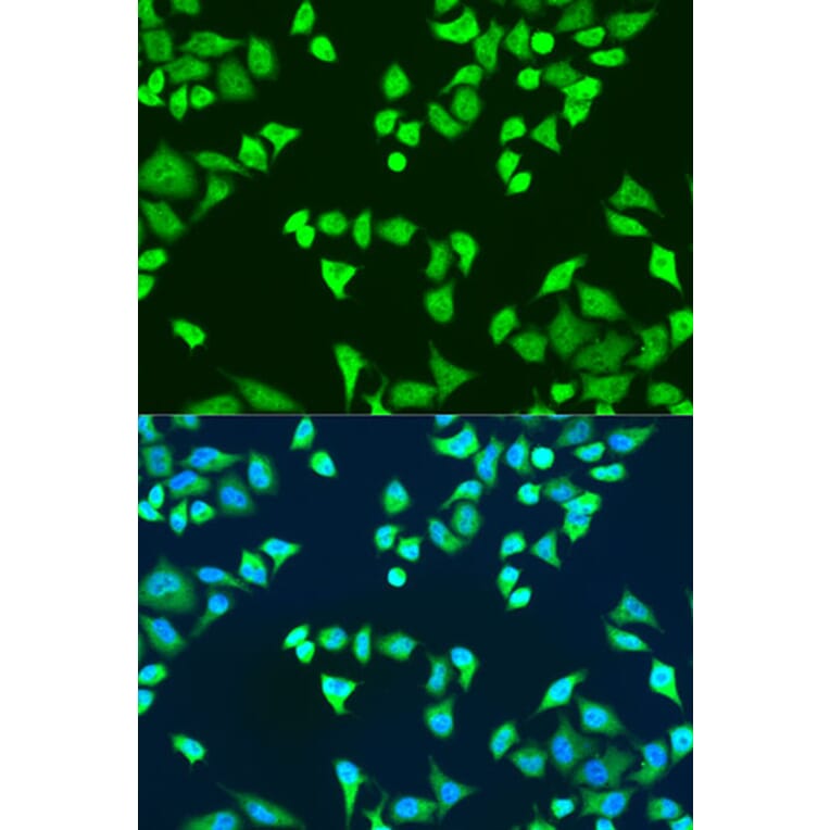 Immunofluorescence - Anti-SMN/Gemin 1 Antibody (A89360) - Antibodies.com
