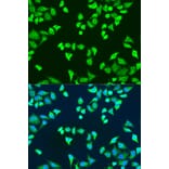 Immunofluorescence - Anti-SMN/Gemin 1 Antibody (A89360) - Antibodies.com