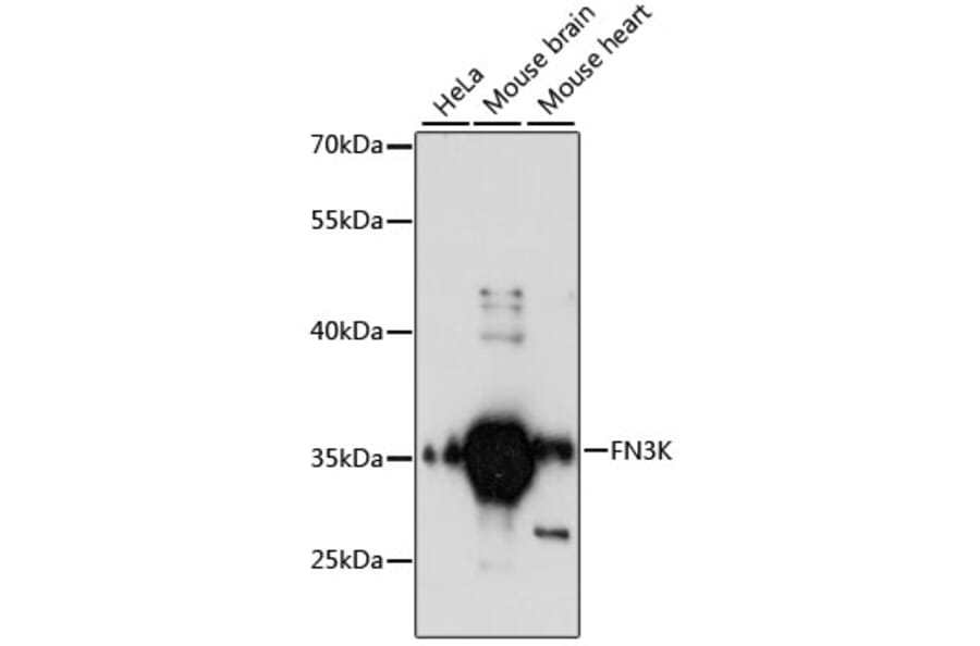 Western Blot - Anti-FN3K Antibody (A89361) - Antibodies.com