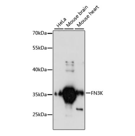 Western Blot - Anti-FN3K Antibody (A89361) - Antibodies.com