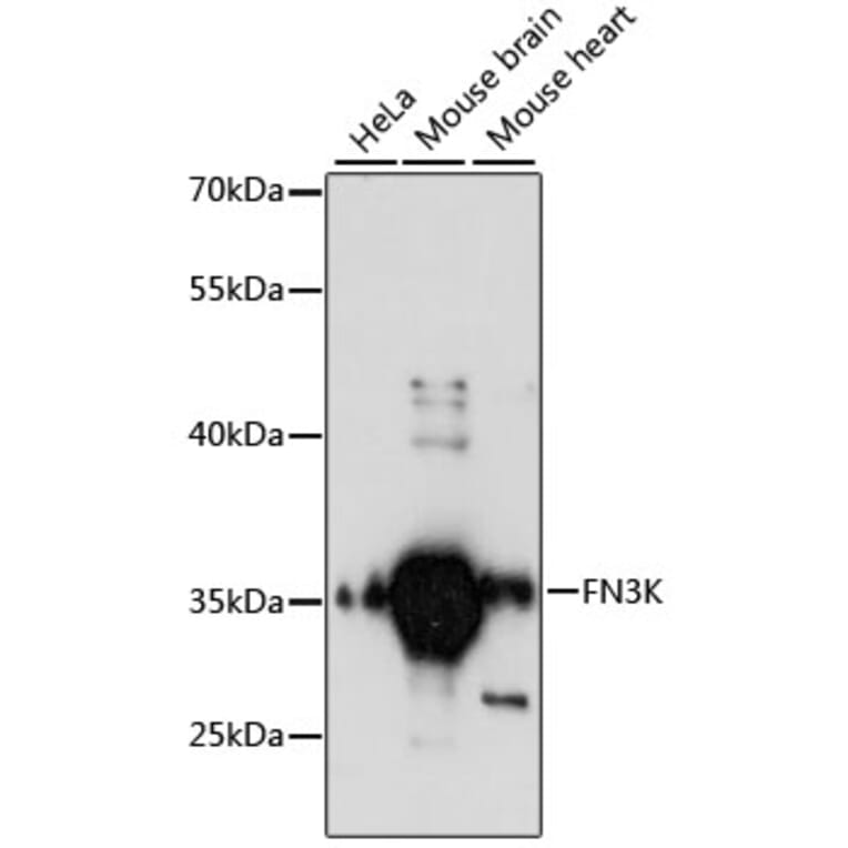 Western Blot - Anti-FN3K Antibody (A89361) - Antibodies.com