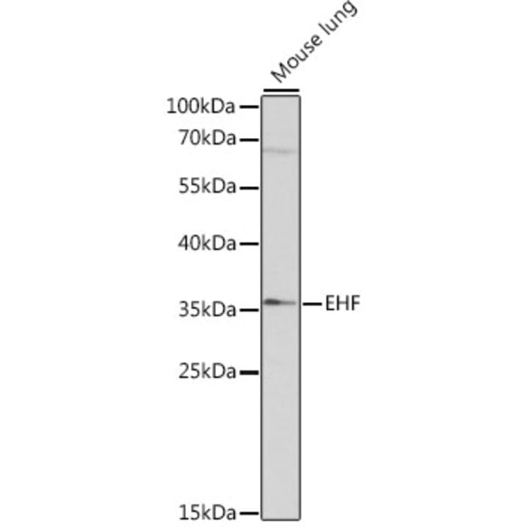 Western Blot - Anti-EHF Antibody (A89362) - Antibodies.com