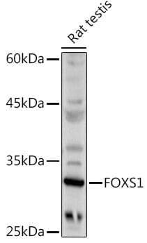 Western blot analysis of extracts of various cell lines, using Anti-FOXS1 Antibody (A14732) at 1:1,000 dilution.
Secondary antibody: Goat Anti-Rabbit IgG (H+L) (HRP) (AS014) at 1:10,000 dilution.
Lysates / proteins: 25µg per lane.
Blocking buffer: 3% non-fat dry milk in TBST.
Detection: ECL Enhanced Kit (RM00021).
Exposure time: 60s.