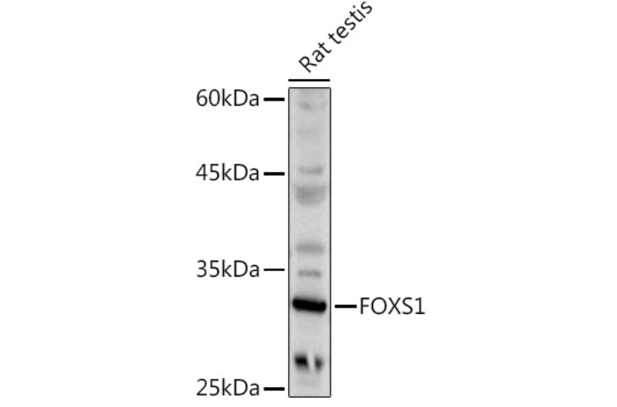 Western Blot - Anti-FOXS1 Antibody (A89363) - Antibodies.com