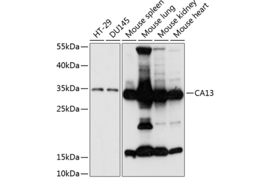 Western Blot - Anti-Carbonic Anhydrase 13/CA13 Antibody (A89364) - Antibodies.com