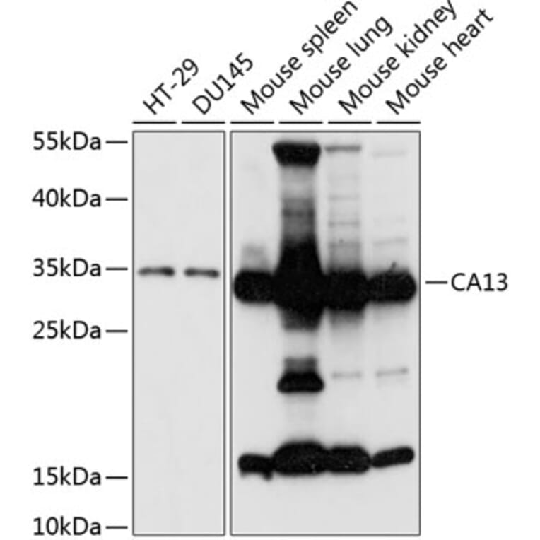 Western Blot - Anti-Carbonic Anhydrase 13/CA13 Antibody (A89364) - Antibodies.com