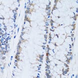 Immunohistochemistry - Anti-Carbonic Anhydrase 13/CA13 Antibody (A89364) - Antibodies.com
