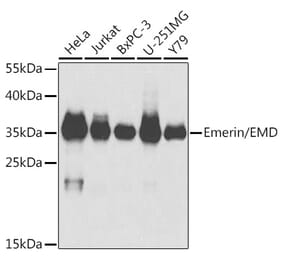 Western Blot - Anti-Emerin Antibody (A89365) - Antibodies.com