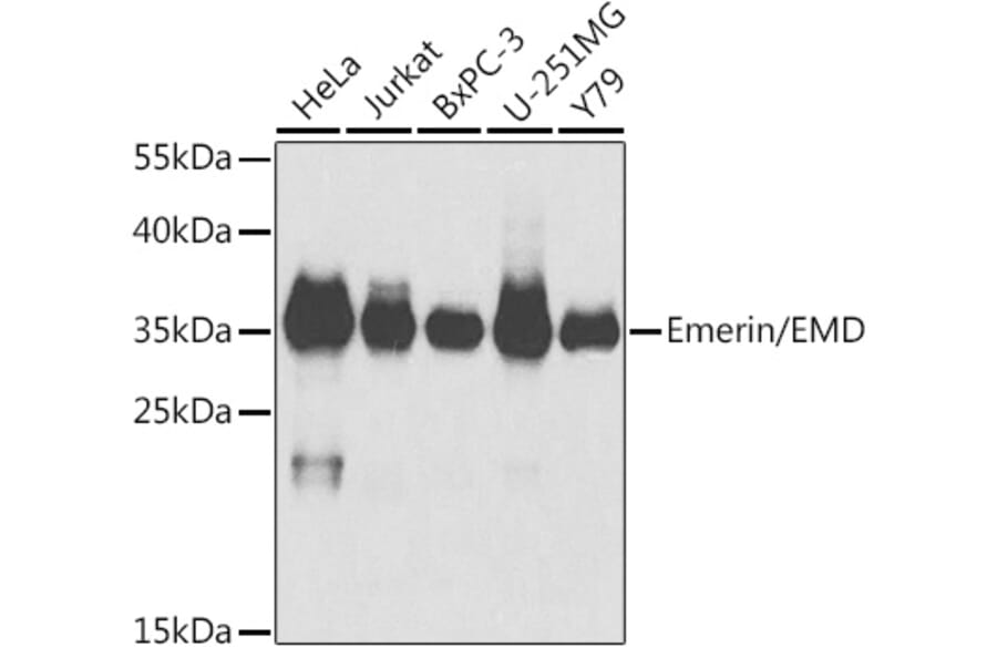 Western Blot - Anti-Emerin Antibody (A89365) - Antibodies.com