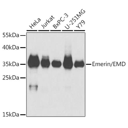 Western Blot - Anti-Emerin Antibody (A89365) - Antibodies.com