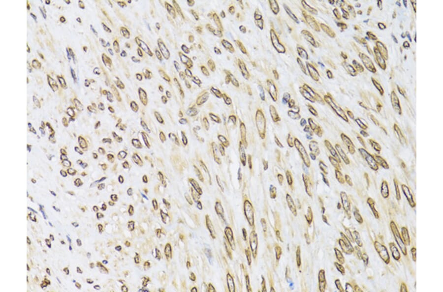 Immunohistochemistry - Anti-Emerin Antibody (A89365) - Antibodies.com