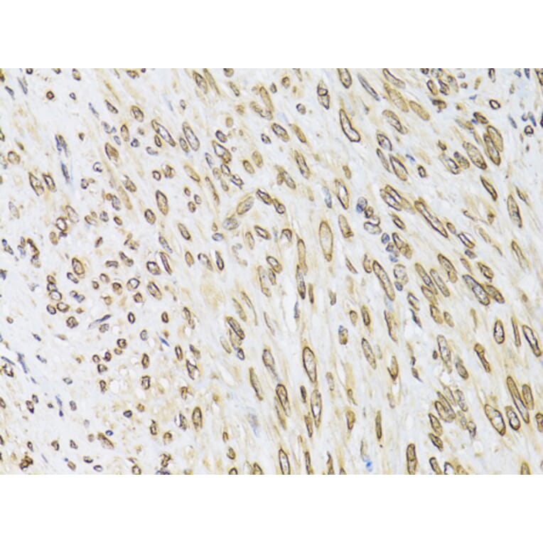 Immunohistochemistry - Anti-Emerin Antibody (A89365) - Antibodies.com