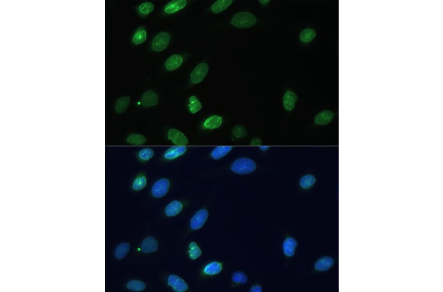 Immunofluorescence - Anti-Emerin Antibody (A89365) - Antibodies.com