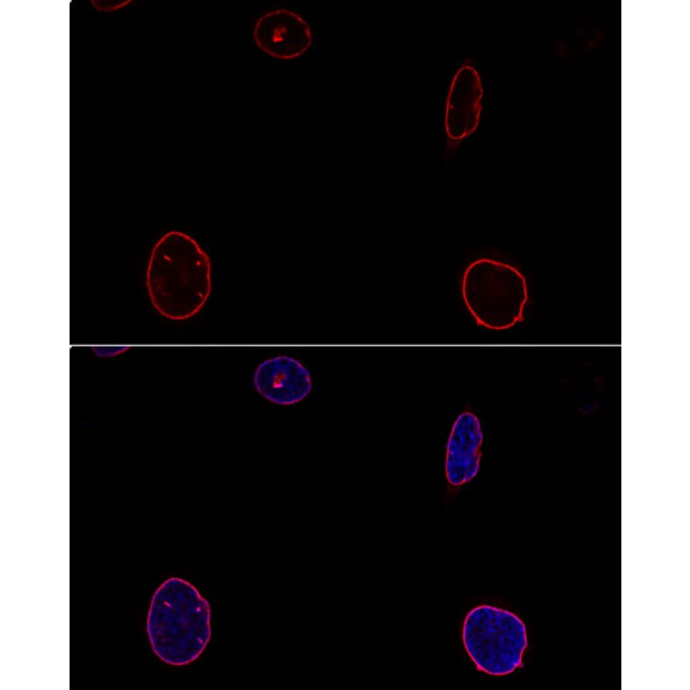 Immunofluorescence - Anti-Emerin Antibody (A89365) - Antibodies.com