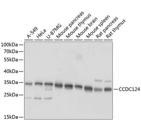 Western Blot - Anti-CCDC124 Antibody (A89366) - Antibodies.com