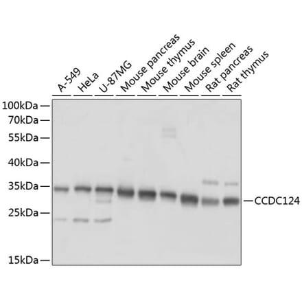 Western Blot - Anti-CCDC124 Antibody (A89366) - Antibodies.com