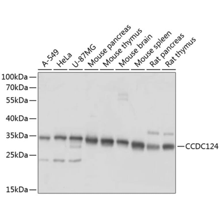 Western Blot - Anti-CCDC124 Antibody (A89366) - Antibodies.com