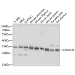 Western Blot - Anti-CCDC124 Antibody (A89366) - Antibodies.com