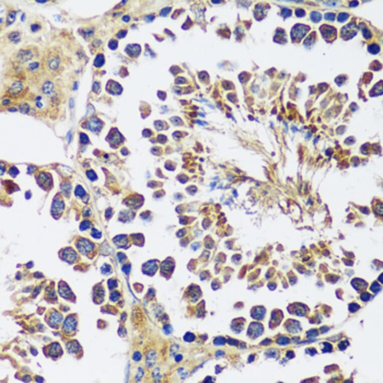 Immunohistochemistry - Anti-CCDC124 Antibody (A89366) - Antibodies.com