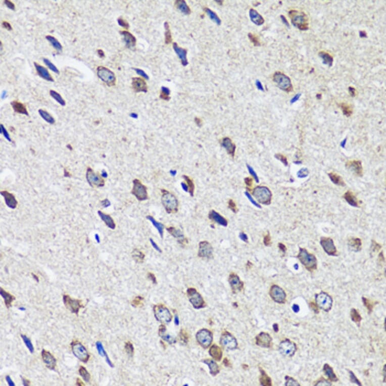 Immunohistochemistry - Anti-CCDC124 Antibody (A89366) - Antibodies.com