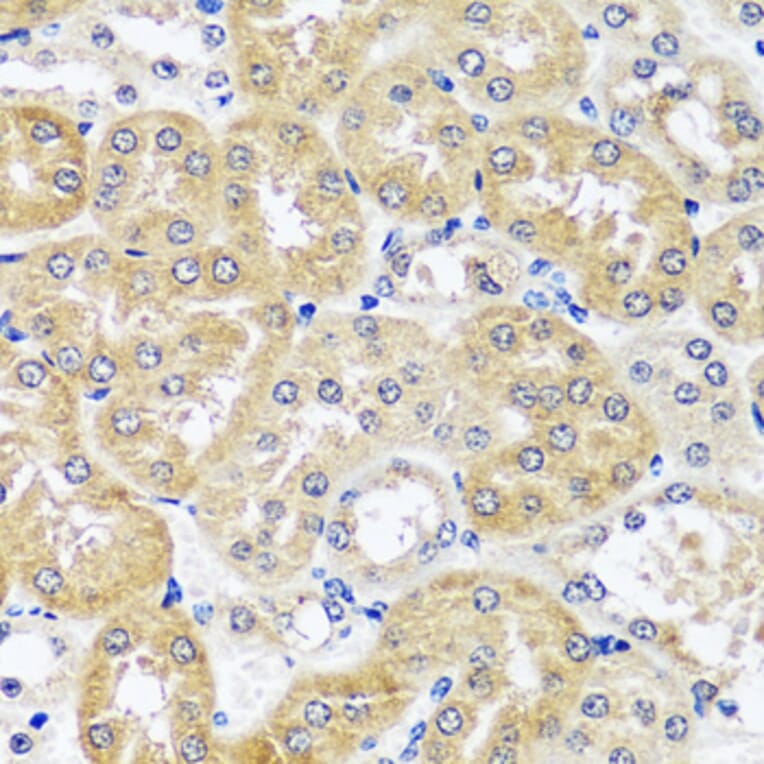 Immunohistochemistry - Anti-CCDC124 Antibody (A89366) - Antibodies.com