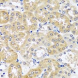 Immunohistochemistry - Anti-CCDC124 Antibody (A89366) - Antibodies.com