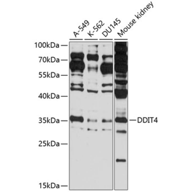 Western Blot - Anti-REDD-1 / DDIT4 Antibody (A89367) - Antibodies.com