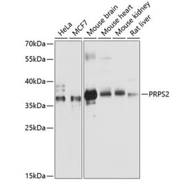 Western Blot - Anti-PRPS2 Antibody (A89368) - Antibodies.com