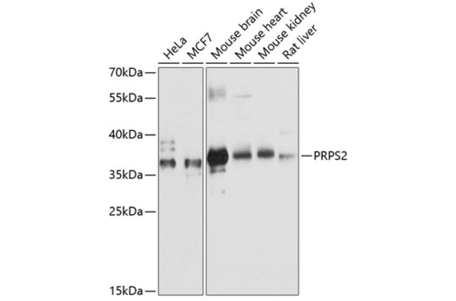 Western Blot - Anti-PRPS2 Antibody (A89368) - Antibodies.com