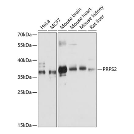 Western Blot - Anti-PRPS2 Antibody (A89368) - Antibodies.com