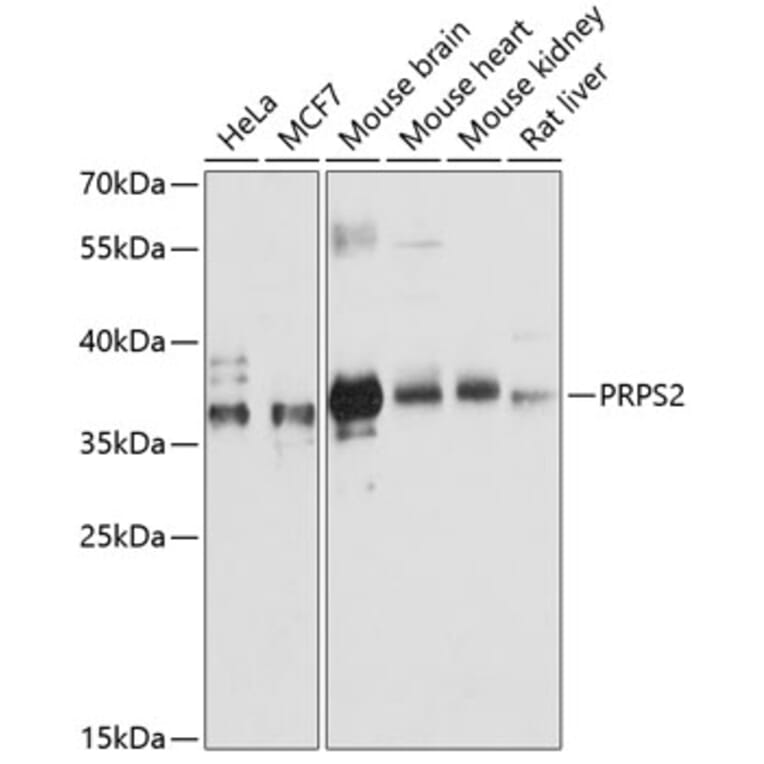 Western Blot - Anti-PRPS2 Antibody (A89368) - Antibodies.com