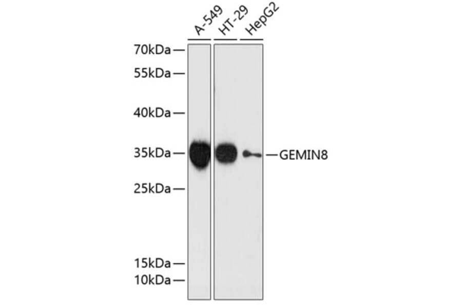 Western Blot - Anti-GEMIN8 Antibody (A89369) - Antibodies.com