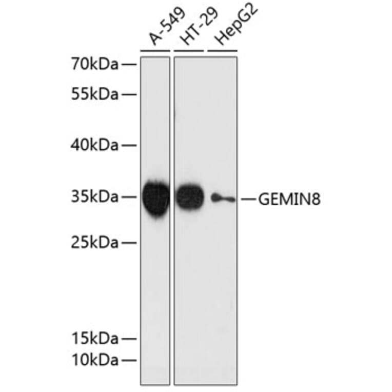Western Blot - Anti-GEMIN8 Antibody (A89369) - Antibodies.com