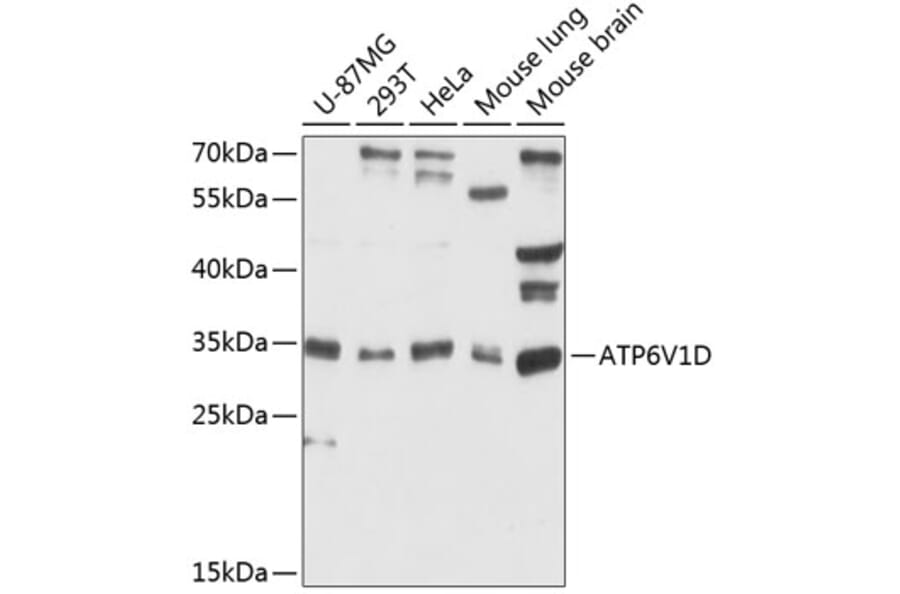 Western Blot - Anti-ATP6V1D Antibody (A89370) - Antibodies.com