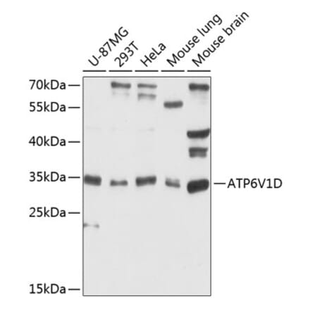 Western Blot - Anti-ATP6V1D Antibody (A89370) - Antibodies.com