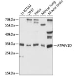 Western Blot - Anti-ATP6V1D Antibody (A89370) - Antibodies.com