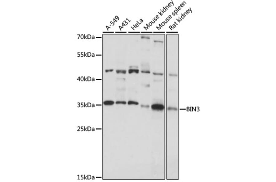Western Blot - Anti-BIN3 Antibody (A89371) - Antibodies.com