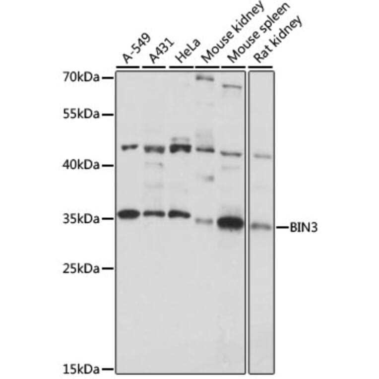 Western Blot - Anti-BIN3 Antibody (A89371) - Antibodies.com