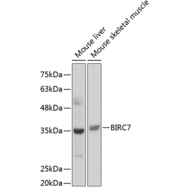 Western Blot - Anti-Livin Antibody (A89372) - Antibodies.com