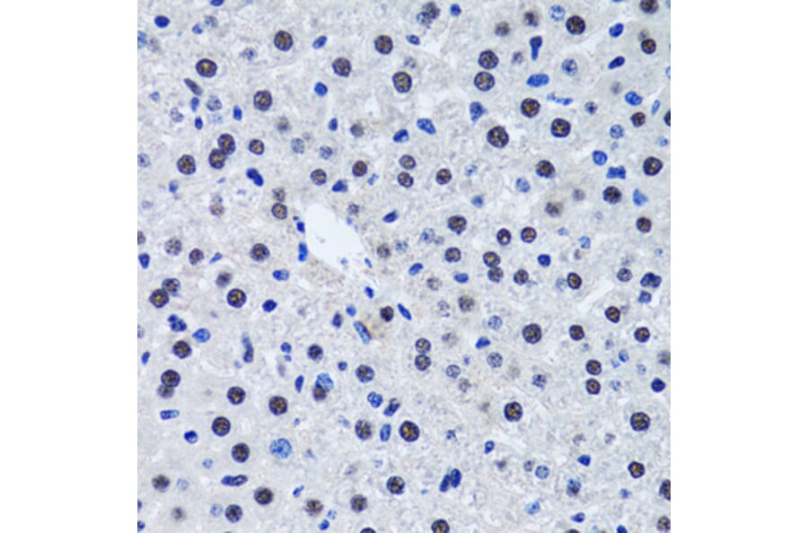 Immunohistochemistry - Anti-Livin Antibody (A89372) - Antibodies.com