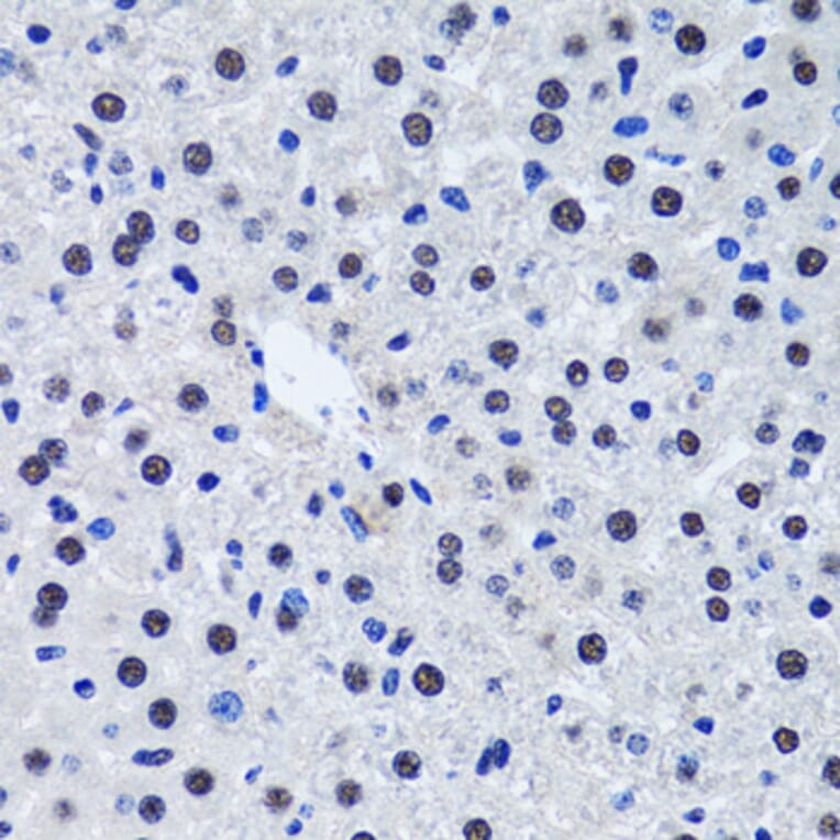 Immunohistochemistry - Anti-Livin Antibody (A89372) - Antibodies.com
