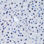 Immunohistochemistry - Anti-Livin Antibody (A89372) - Antibodies.com