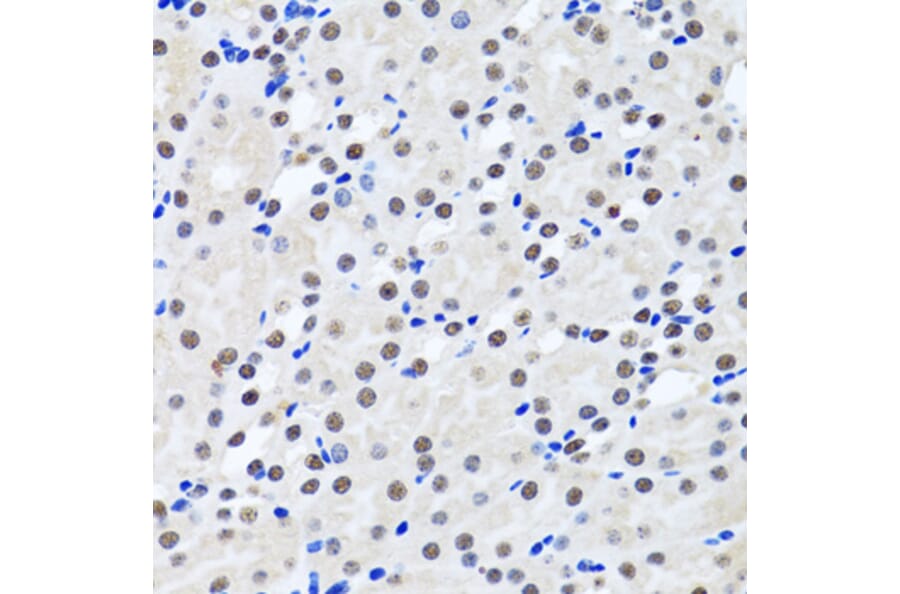 Immunohistochemistry - Anti-Livin Antibody (A89372) - Antibodies.com