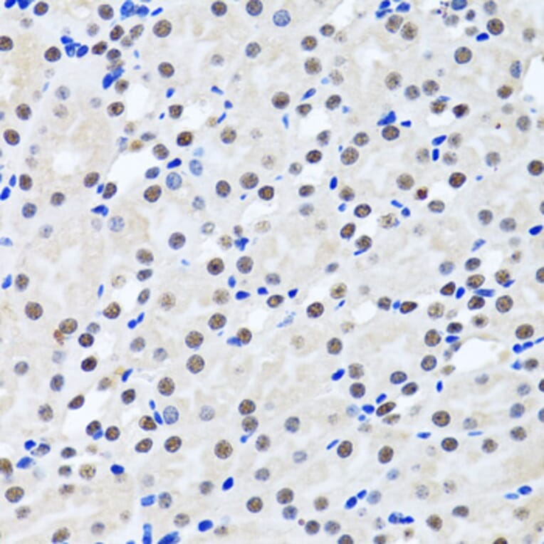 Immunohistochemistry - Anti-Livin Antibody (A89372) - Antibodies.com