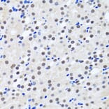 Immunohistochemistry - Anti-Livin Antibody (A89372) - Antibodies.com
