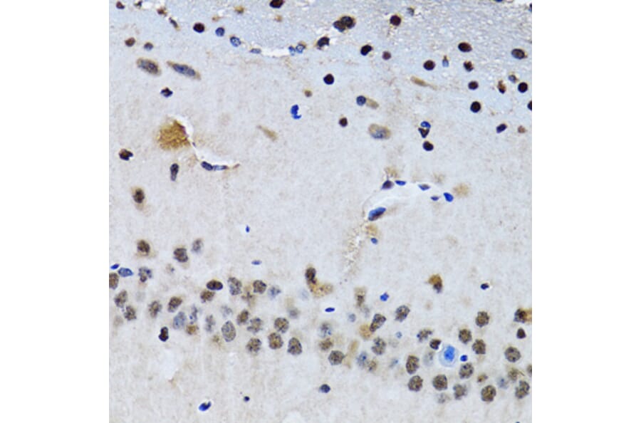 Immunohistochemistry - Anti-Livin Antibody (A89372) - Antibodies.com